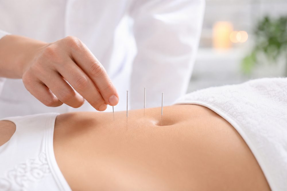 妊活向けの鍼治療で腹部にツボへ施術しているシーン
